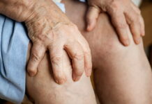 Inchaço e manchas nas pernas podem ser sinais de alerta Idosa dor nas pernas