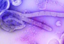EUA adotam restrições após avanço do ebola ebola