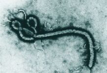 São Paulo investiga caso suspeito de Ebola em homem de 37 anos DIVULGAÇÃO