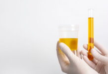 hábitos comuns aumentam os riscos infecção urinária