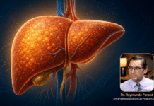 gordura no fígado preocupa mais que as hepatites gordura no fígado preocupa mais que as hepatites