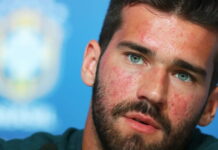 os sinais da doença revelada por Alisson Becker rosácea