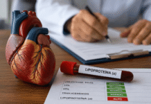 Colesterol normal nem sempre protege contra infarto e AVC Colesterol normal nem sempre protege contra infarto e AVC