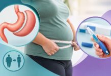Bariátrica e canetas emagrecedoras: como tratam a obesidade emagrecimento