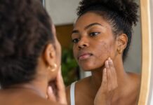 Hiperpigmentação afeta autoestima de pessoas negras mulher negra diante do espelho