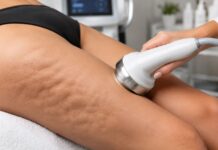veja como funcionam as principais técnicas tratamento celulite