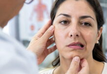 Paralisia facial tem diferentes causas e exige diagnóstico rápido paralisia facial